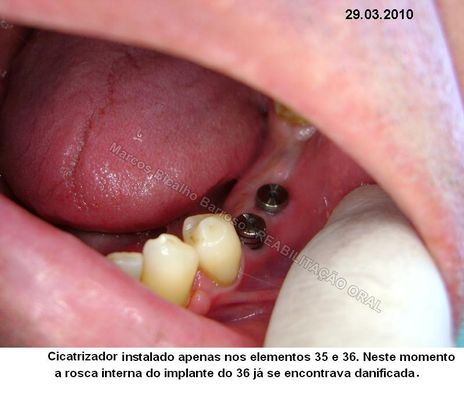 Respostas de nata de peito de respostas de fonte de água mineral de nata de busto
