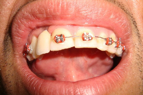 Dr. João Miguel Fraga de Calais, Cirurgião Dentista Implantodontista