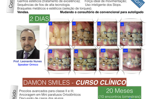 Cursos 2018 - Ortodontia Autoligada pelo Damon Smiles em Pelotas/RS