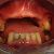 Foto inicial intra-oral sem a PPR superior