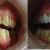Antes/depois