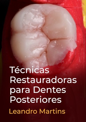 Técnicas Restauradoras para Dentes Posteriores