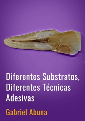 Diferentes Substratos, Diferentes Técnicas Adesivas