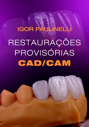 Assista online: Restaurações Provisórias CAD/CAM | iDent