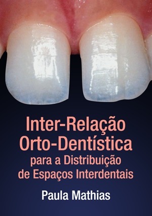 Inter-relação Orto-dentística para a Distribuição de Espaços Interdentais