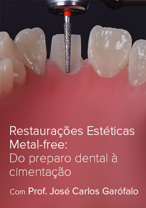 Restaurações Estéticas Metal-free: Do preparo dental à cimentação