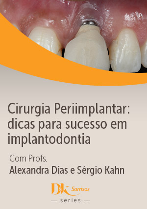 Cirurgia Periimplantar: Dicas para Sucesso em Implantodontia
