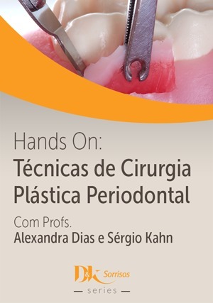 Hands On Técnicas de Cirurgia Plástica Periodontal