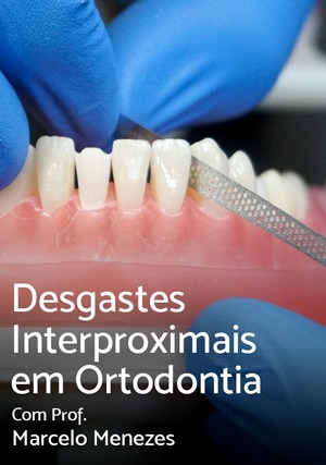 Desgastes Interproximais em Ortodontia