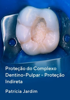 Proteção do Complexo Dentino-Pulpar - Proteção Indireta
