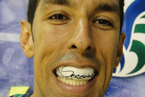 Serginho mostra o protetor bucal personalizado (Foto: Roberto Filho / Globoesporte.com) Serginho mostra o protetor bucal personalizado (Foto: Roberto Filho / Globoesporte.com)