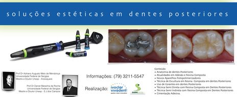 Soluções Estéticas em Dentes Posteriores