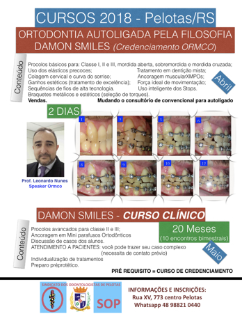 Cursos 2018 - Ortodontia Autoligada pelo Damon Smiles em Pelotas/RS