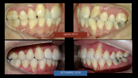 Damon Smiles - Prof Leonardo Nunes