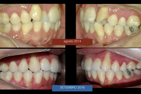 Damon Smiles - Prof Leonardo Nunes