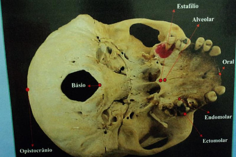PONTOS CRANIOMÉTRICOS PONTOS CRANIOMÉTRICOS