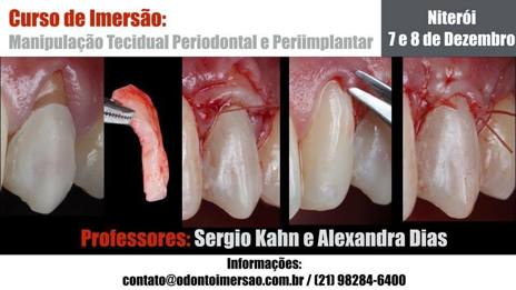 Manipulação Tecidual Periodontal e Periimplantar (Ganhe R$ 140,00 de Desconto*)