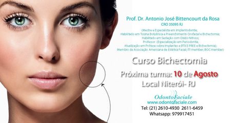 Curso de Bichectomia com Dr Antônio Bittencourt