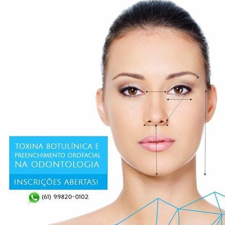 Toxina Botulínica na Odontologia