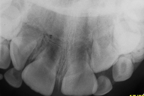 Radiografia de diagnóstico