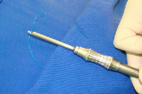 Ancora para ancoragem do disco articular
