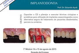 IMPLANTODONTIA: Curso de Aperfeiçoamento cirúrgico e protético.