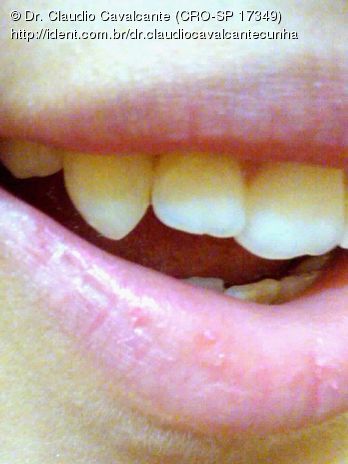 Featured image of post Pessoas Com Dentes Afiados - Carnívoros tem dentes afiados e dilaceradores;