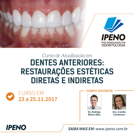 Atualização de Dentes Anteriores