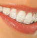 Dra. Grazielle Simon Clínica Odontológica (Ortodontista)