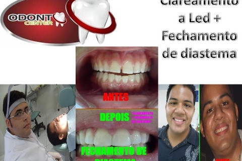 (foto concedida e permitida para postagens pelo paciente, amigo particular). (foto concedida e permitida para postagens pelo paciente, amigo particular).