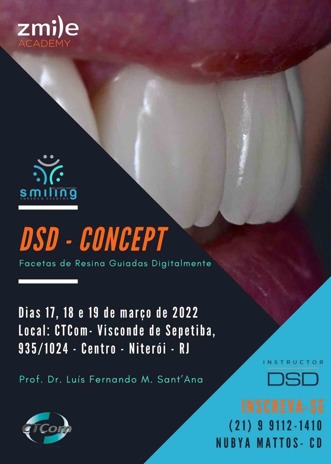 Dsd - Concept Facetas de Resina Guiadas Digitalmente