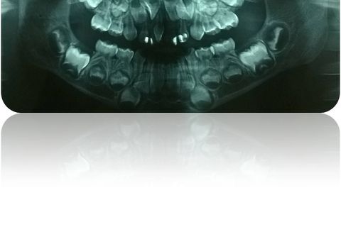 Radiografia Panorãmica