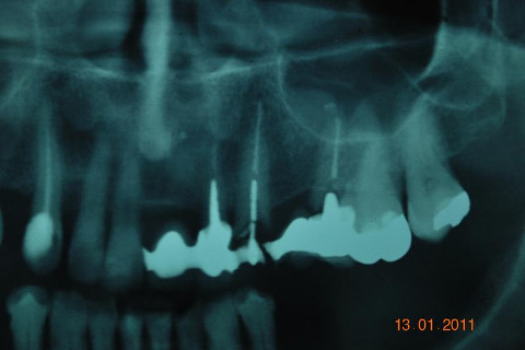 Radiografia Inicial