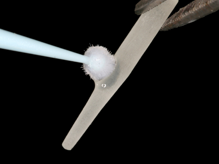 Allcem Core e sua Versatilidade: Cimentação de Retentor Intrarradicular