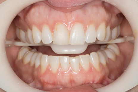 Aspecto clínico inicial.