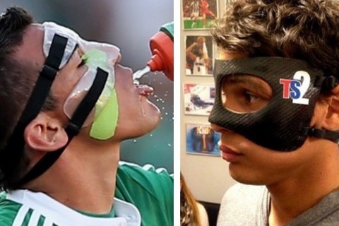 A esquerda, o atleta Lúcio (Palmeiras) utilizando protetor facial confeccionado pelo dentista. Na imagem a direita, o jogador Thiago Silva do PSG utilizando protetor facial pré-fabricado com falha de adaptação e comprometendo a visão periférica. A esquerda, o atleta Lúcio (Palmeiras) utilizando protetor facial confeccionado pelo dentista. Na imagem a direita, o jogador Thiago Silva do PSG utilizando protetor facial pré-fabricado com falha de adaptação e comprometendo a visão periférica.