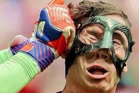 Atacante do Bayern de Munique Robert Lewandownski utilizando protetor facial pré-fabricado durante dividida de bola. Atacante do Bayern de Munique Robert Lewandownski utilizando protetor facial pré-fabricado durante dividida de bola.