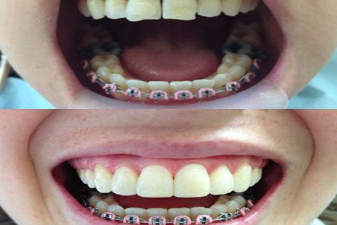 Comparando antes e depois do tratamento Comparando antes e depois do tratamento