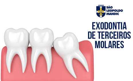 Imersão em Exodontia de Terceiros Molares (Mec) Cód.: 4961