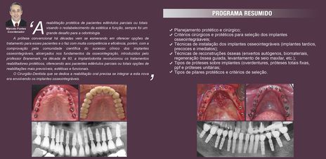 Curso de Especialização em Implantodontia