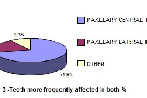 Graph 3 -Teeth more frequently affected in both %
