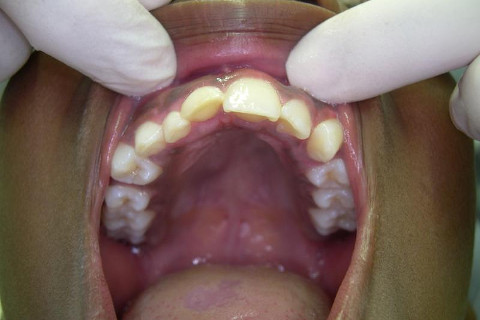 Vista oclusal