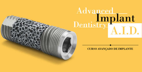 Mini residência em Implantes dentais