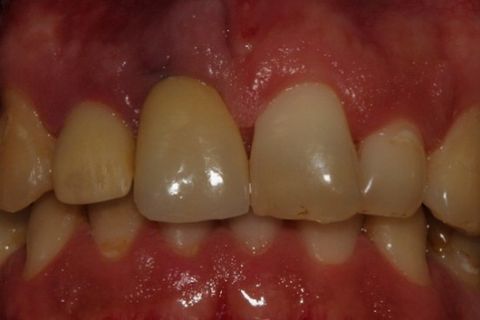 Jaqueta Deficiente esteticamente Jaqueta Deficiente esteticamente