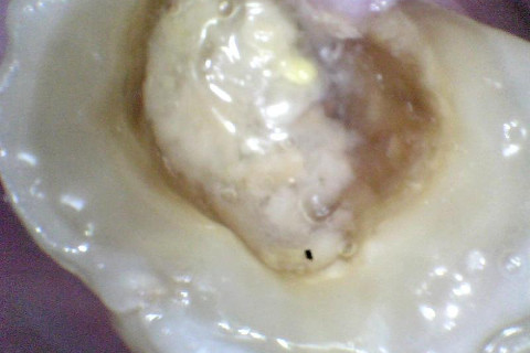 Antes. Dente sendo recuperado sem o tratamento de canal Antes. Dente sendo recuperado sem o tratamento de canal