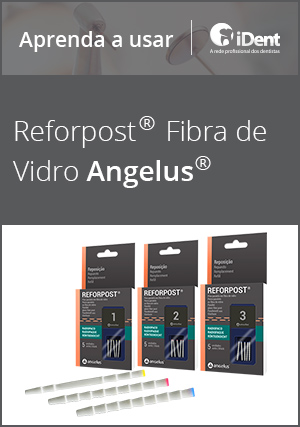 Aprenda a usar: Reforpost Fibra De Vidro Angelus